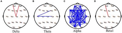 Exploring brain network oscillations during seizures in drug-naïve patients with juvenile absence epilepsy